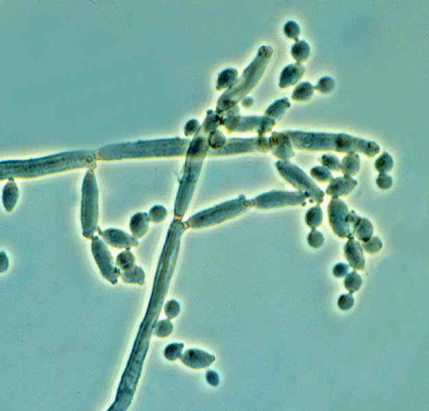 Cladosporium Cladosporium cladosporioides